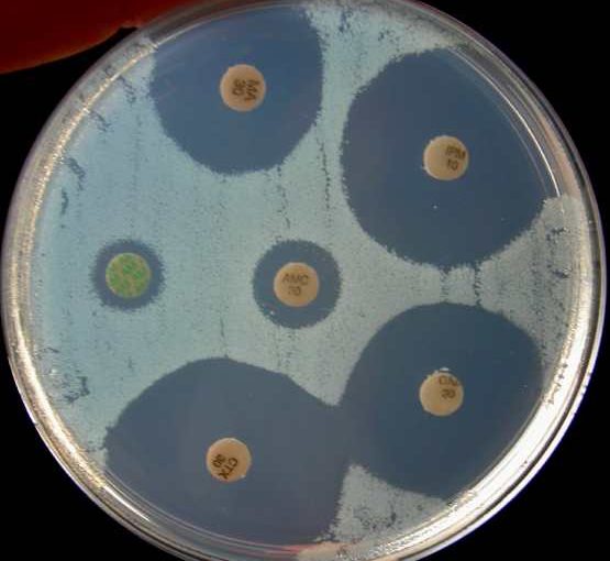 1ère spé TP10 la résistance des bactéries aux antibiotiques